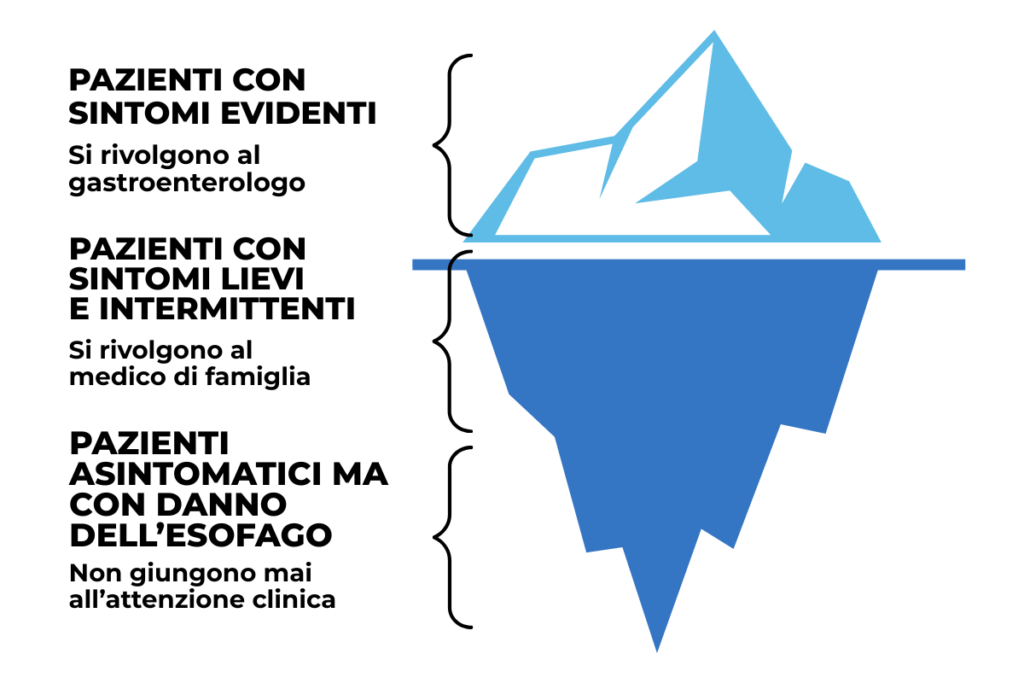Malattia da reflusso gastroesofageo: il paradigma dell'iceberg GERD - Prof. Domenico D'Ugo.